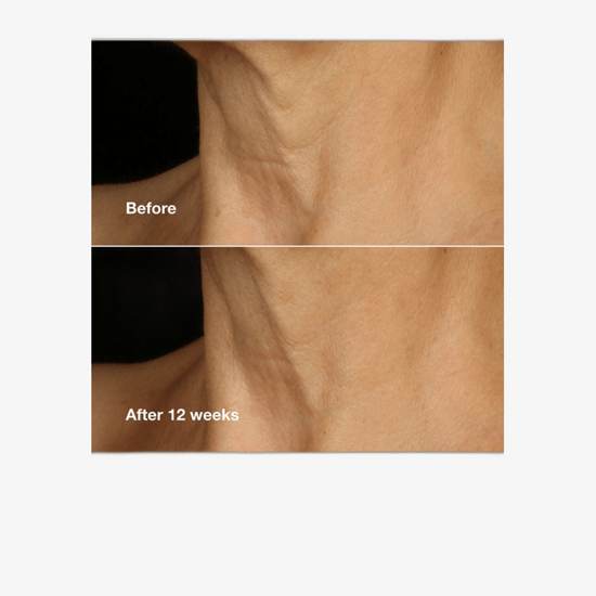 Clinique Smart Clinical Repair Lifting Cream packaging